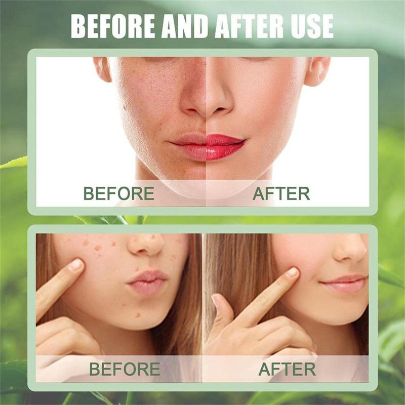 Green Tea Extract Mud Mask For Face Gentle Cleansing Blackheads Acne Remover Oil Control 40g