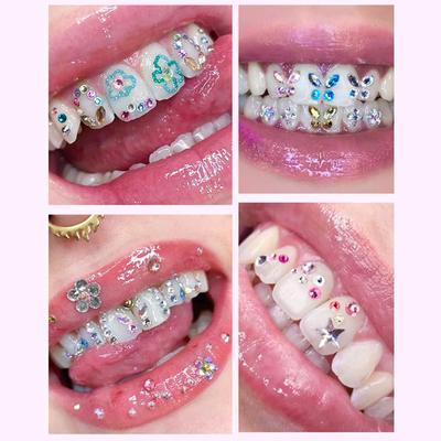 Ornements de bijoux de dents de foret dentaire avec la boîte autocollants de bricolage dents gemmes beauté diamant dentaire dents bijoux gemme décoration
