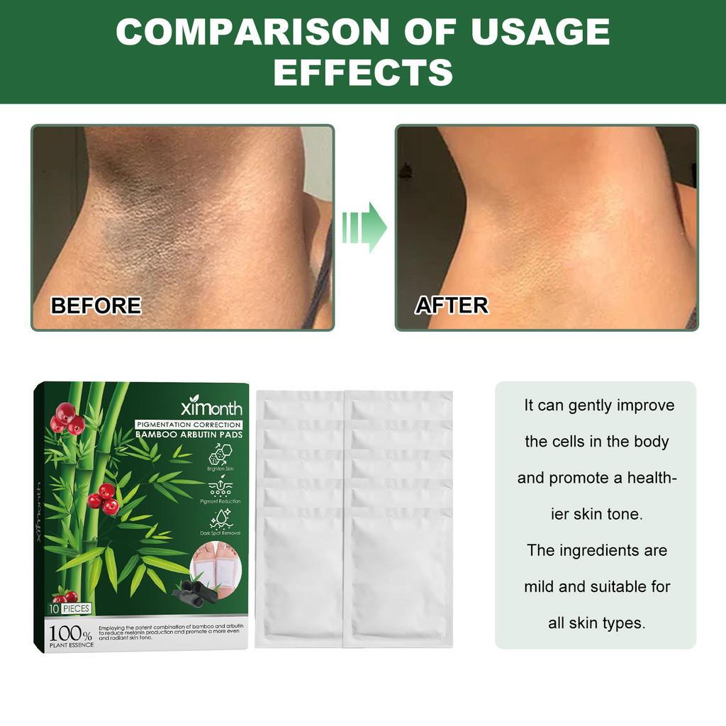 Ximonth Bamboo Charcoal Deep Cleansing Foot Patches For Stress Relief And Improved Sleep