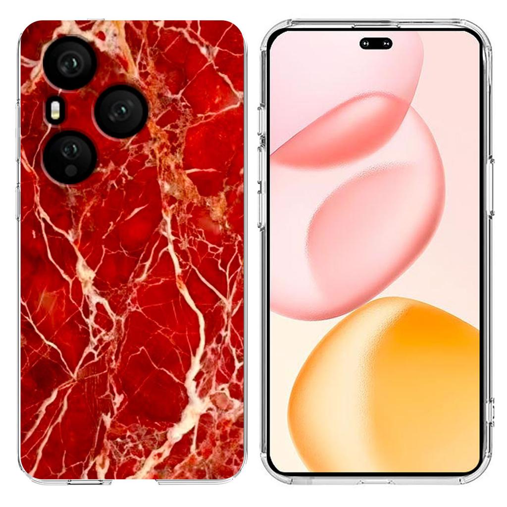 For Honor 400 Pro 5G (Global) Case Marble Pattern Printing Soft TPU Phone Cover