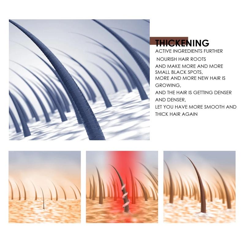 Shampoing au riz, traitement de la croissance des cheveux, contrôle de l'huile, barre de shampoing nourrissante, Anti-perte de cheveux, 100g
