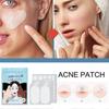 240Pcs Large Acne Patch Pimple Hydrocolloid Stickers Spot Cover Remover Treatment