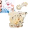 Transparent Dental Implant Pathological Model Implant Disease Teeth Model for Teaching Demonstration