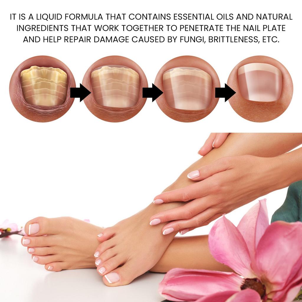 15ml Nail Strengthening Cuticle Oil, Nail Care Moisturizing And Brightening Nails, Care Oil