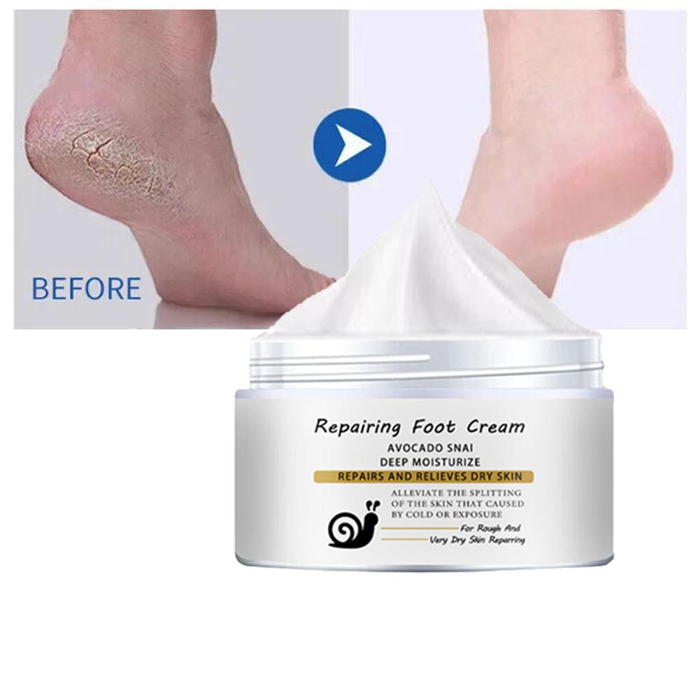 Repair Foot Cream for chapped, broken hands/heels, natural essence cream, gentle and non-irritating
