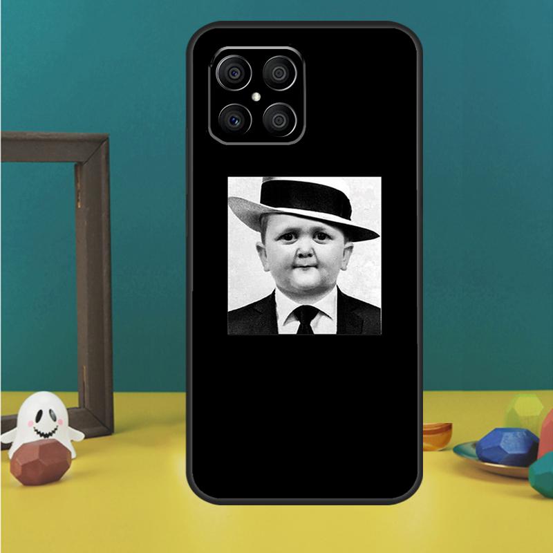 Funny Hasbulla Case For Honor X9c X8a X8b X9b X9a X8 X9 50 70 90 Lite Honor 200 Pro Magic 5 6 7 Lire Cover