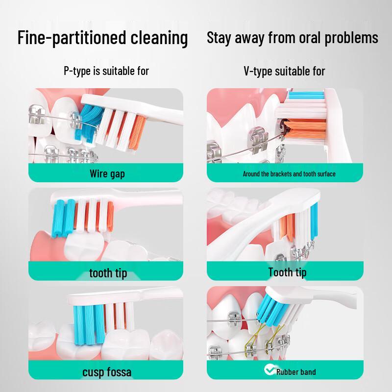 meyarn PV Type Orthodontic Toothbrush 2-Pack