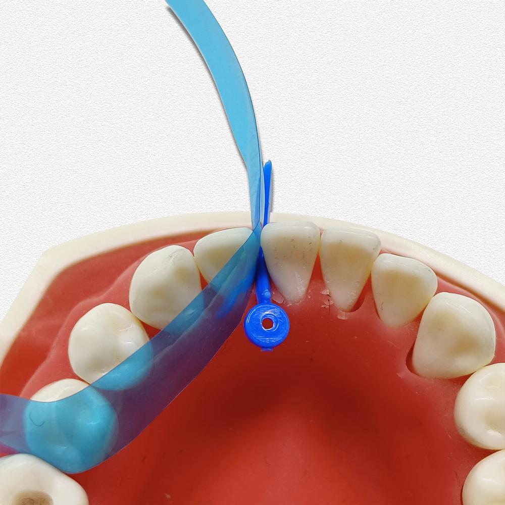 15pcs/50pcs Dental Contoured Anterior Matrix Blue Transparent Anterior Polyester Strip Thickness 0.05mm Dental Materials