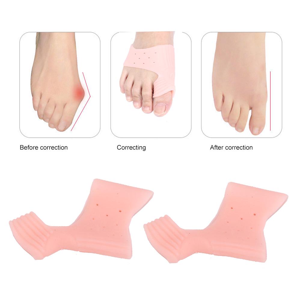 2 Pairs Bunion Hallux Valgus Corrector Elastic Breathable Toe Separator Correction ToolSkin Color