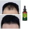 Natural Herbal Essence Anti-Hair Loss Hair Serum For Thinning Hair Thickening and Reawakening