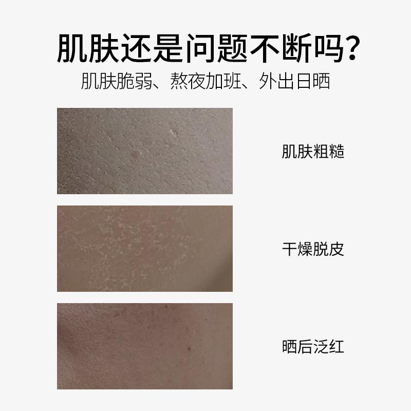 Fuyiqing Snow Grass Resurrection Grass Soothing and Protective Patch