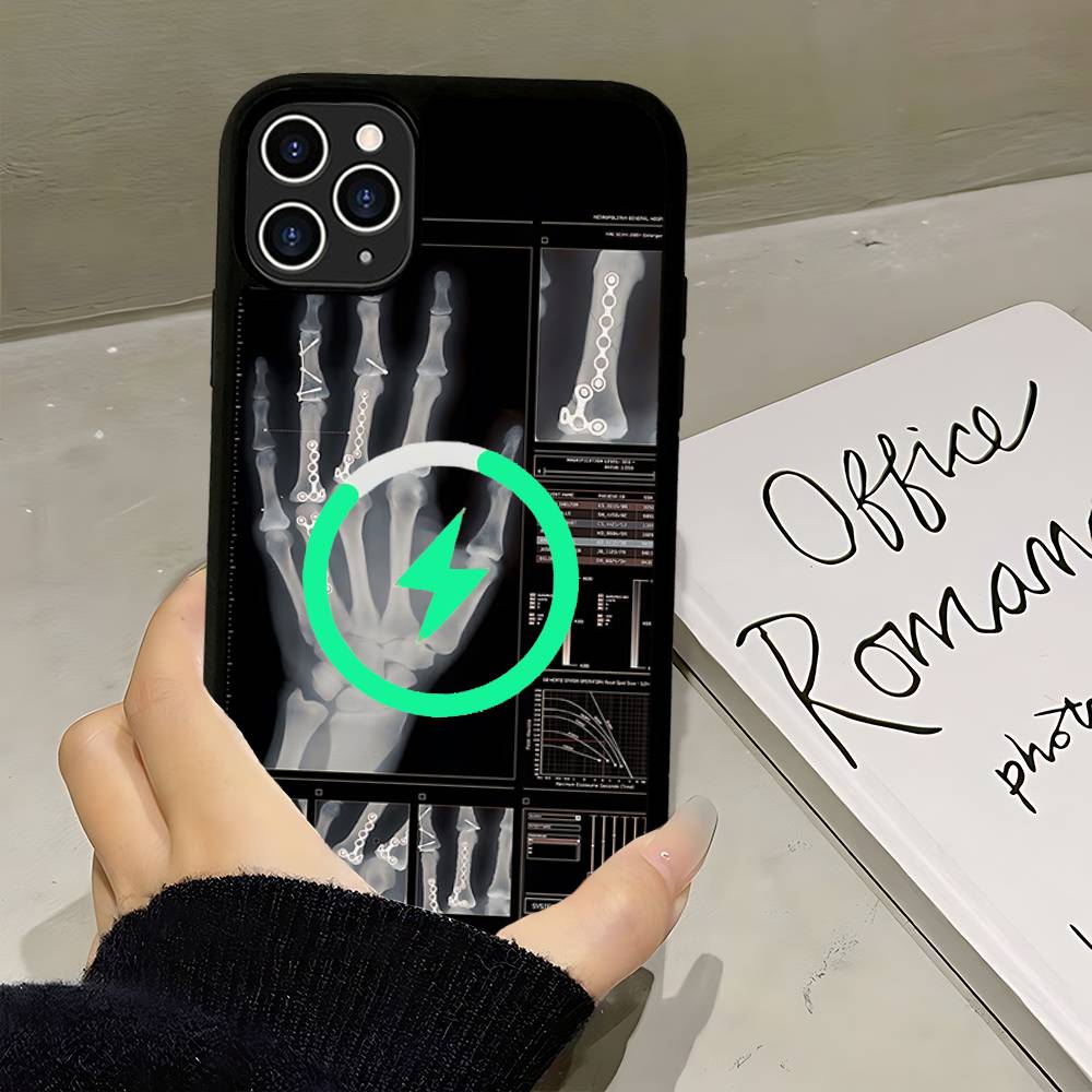 Radiological Human Organs Skeleton For Magsafe Magnetic Case For IPhone 17 Air 16 15 14 13 12 11 Pro Max Plus Wireless Charging
