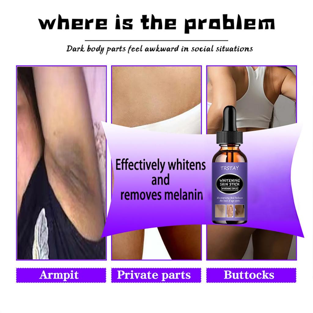 Whitening and Moisturizing Cream for Even Skin Tone and Dark Spots Reduction