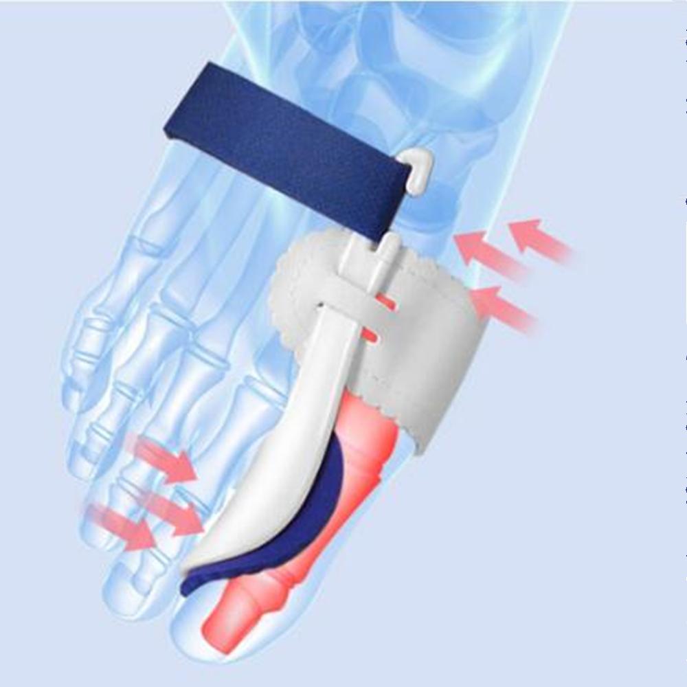 1Pair Big Toe Valgus Straighteners Night Splint Corrector Pain Ease