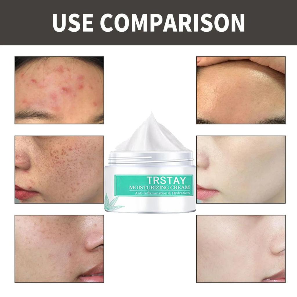 Gentle and Non-irritating, the Nourishing Skin Cream Tightens the Skin, Hydrates and Brightens the Complexion, Leaving the Skin Soft and Refined