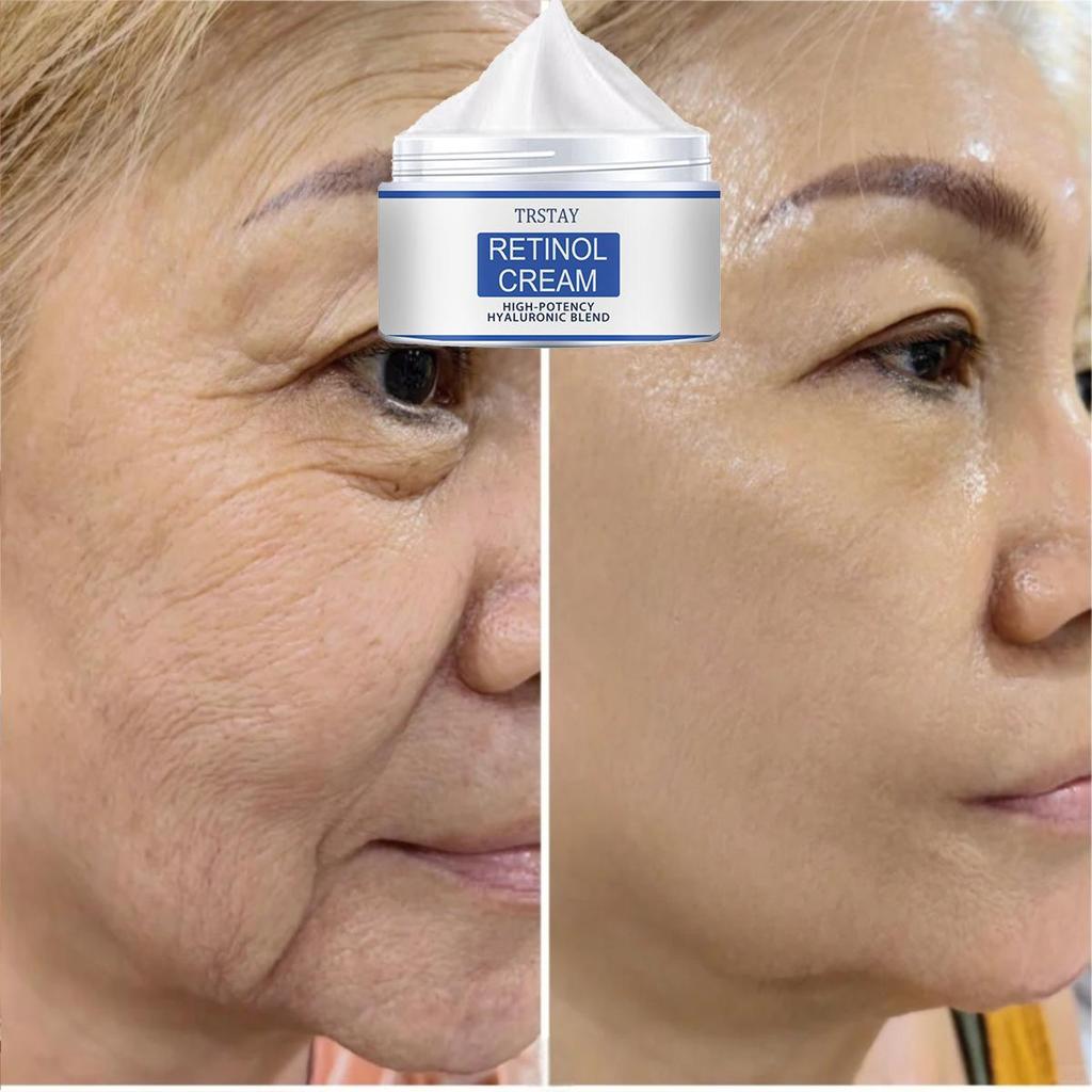 The Cream Is Gentle and Non-irritating, Smoothing Wrinkles, Lightening Fine Lines and Leaving the Skin Soft and Refined