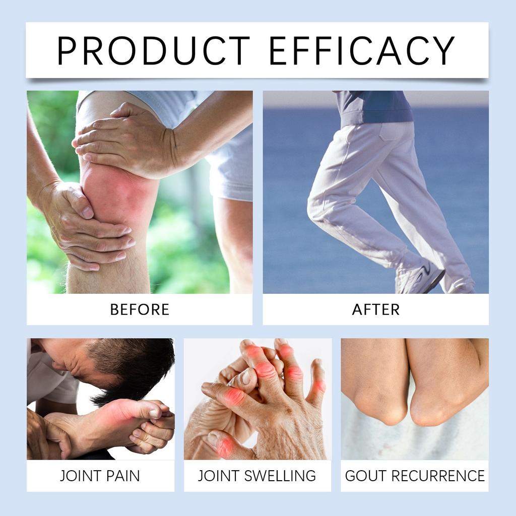 GoutOintment GoutOintmentCream OriginalArthritis Pain ReliefCream Ointment For Goutand  Pain RelieverCream Ointment