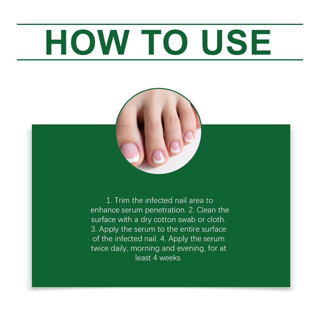 Nail Care Lotion, A Moisturizing Serum For Hands And Feet Nails, Reduces Dead Skin And Smoothens The Nail Surface.30ml