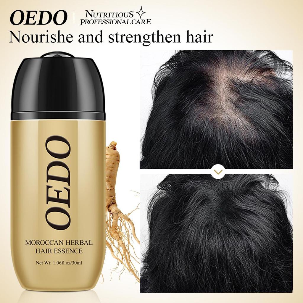 OEDO L'essenza marocchina per capelli alle erbe ripara la permanente e i follicoli piliferi danneggiati dopo la tintura previene la perdita dei capelli nutre i capelli ammorbidisce e lucida