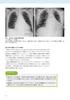 Chest Imaging and Thoracic Surgery