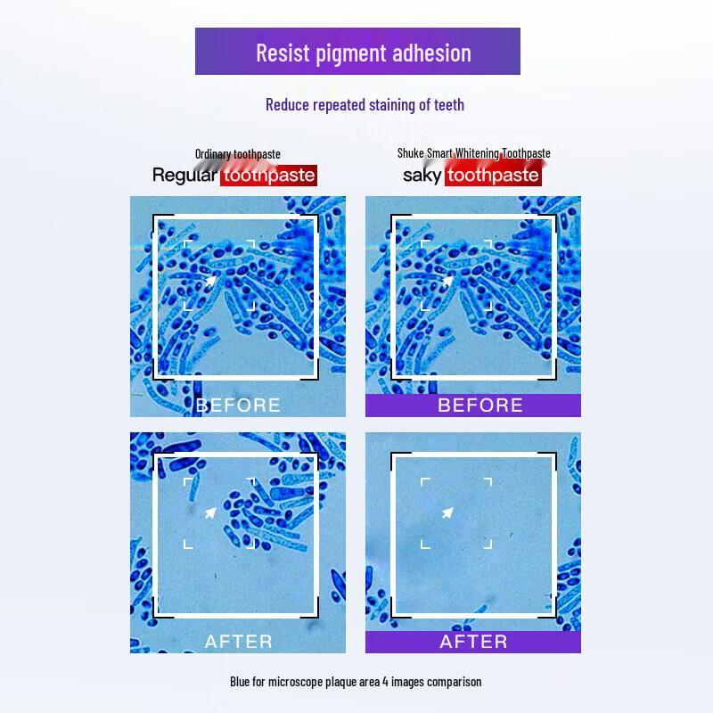 Shuke Intelligent Whitening Toothpaste Set