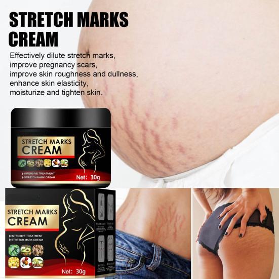 Functional Healthy Lighten Scars Improve Moisture Mommy Care Belly Maternity Marks Gel for Abdomen  Ointment