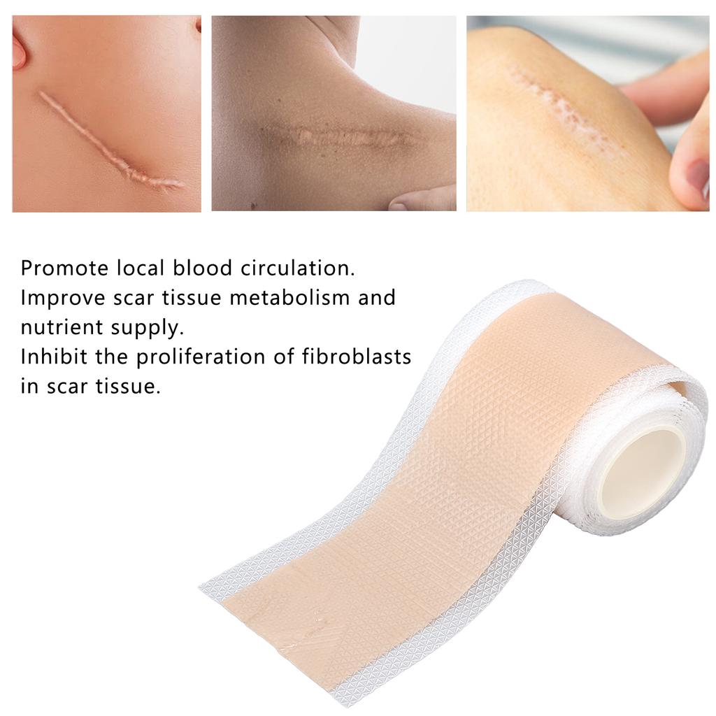 Scar Removal Gel Tape Self Adhesion Reusable Painless Scars Treatment Tapes for Hyperplastic Scars 59.1in