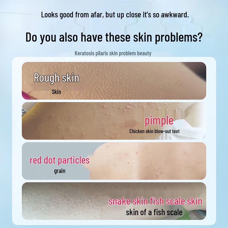 

UNMS Keratosis Pilaris Smoothing Body Lotion