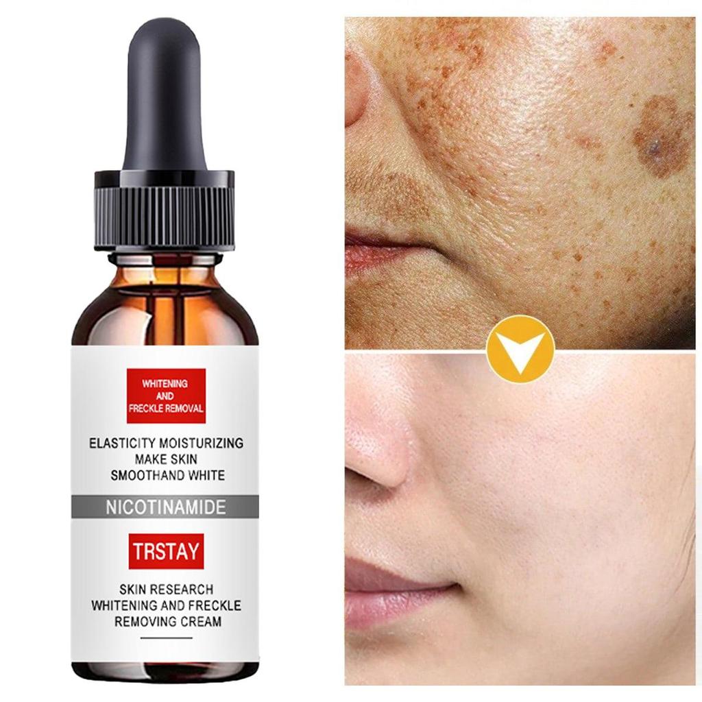 Lighten Spots And Moisturize Face Cream To Brighten Skin Tone And Fight Off