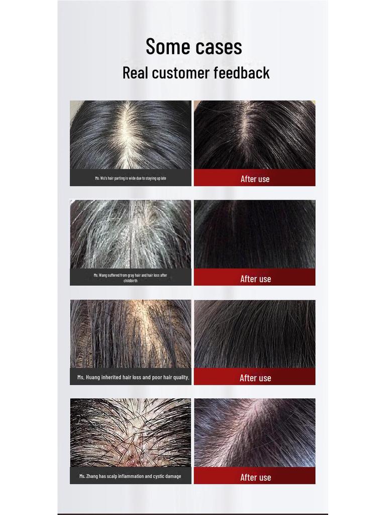 Saç Bakımı ve Saç Dökülmesine Karşı Kırmızı ve Mavi Iıklı Elektrikli Masaj Tarağı