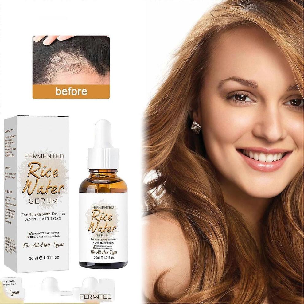 Rice Water Hair Growth Serum, 2Pcs Rice Water for Hair Growth, Rice Water Serum, Nourishing and Growth-stimulating Serum