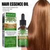 Rosemary Essential Oil Nourishes Repairs Improves Frizz Prevents Hair Loss Eliminates Itching Thinning Damaged Hair Care