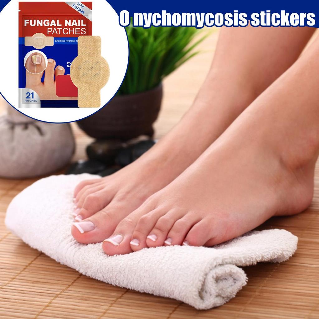 NailFungus Patch Waterproof Nail Repair Patch Ingrown Correction Sticker Damaged Nail Gray Care Patch Feet Care Tools