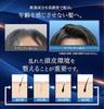 BimoRa Hair Growth Tonic, Scalp Care, Promotes Hair Growth, Prevents Thinning Hair, and Prevents Hair Loss, Quasi-drug, 100ml (1 Bottle)