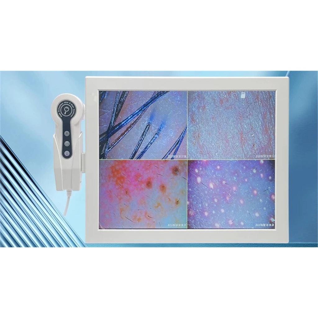 HD Digital Skin Analyzer Professional Hair Scalp Camera Detector Hair Follicle Oil Moisture Test Device 15inch