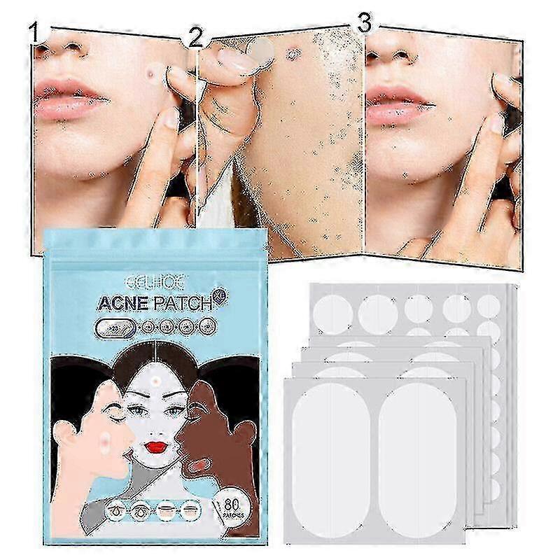 320pcs Large Acne Patch Pimple Hydrocolloid Stickers Spot Cover Remover Treatment