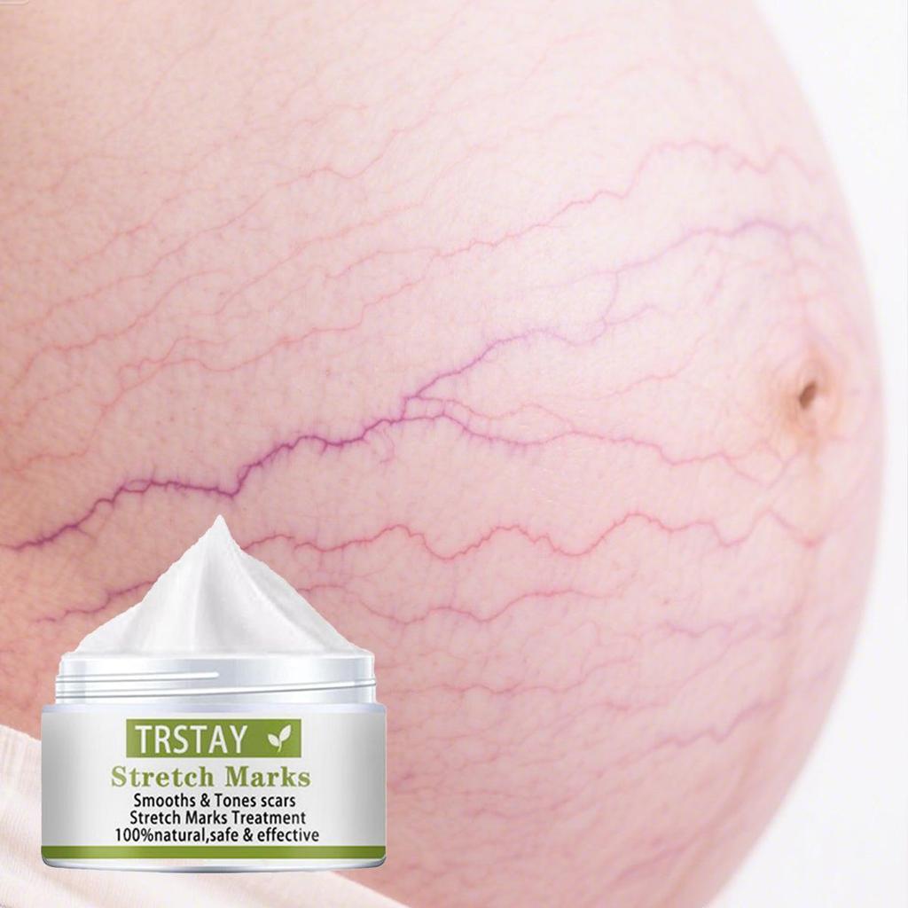 Těhotné ženy opravují rýhy na břiše, tělový krém proti vyblednutí, hydratují produkty péče o pleť, odstraňují těhotenské vrásky, tukové rýhy, krém na obličej