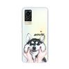 Transparent Tpu Coque Cover For Vivo X60 Pro Case High Quality Luxury Silicone Soft Phone Case For Vivo X60 4G 5G X60T X 60 Case
