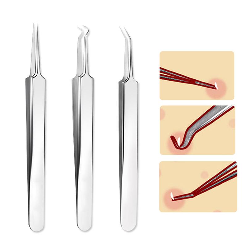 Needle Tweezers Blackhead Pimples Removal Pointed Bend Head Face Care Tools