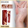 EELHOE Whitening Cream Armpits Knees Arms Thighs Skin Whitening Remove Spider Pain Relief Ointment Herbal Plaster Beauty Body Health Care