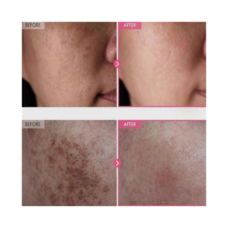 TOSOWOONG Arbutin 7% Tranexamic Acid 4% Cream 50ml Brightening K-Beauty 2025