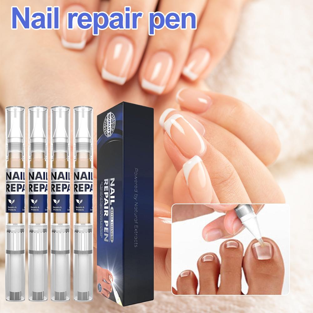 Nail Fungal Liquid Fast Onychomycosis Fungus Nails Demethylation Essential Oil Natural Plant Extracts Nail Shine Nail Care