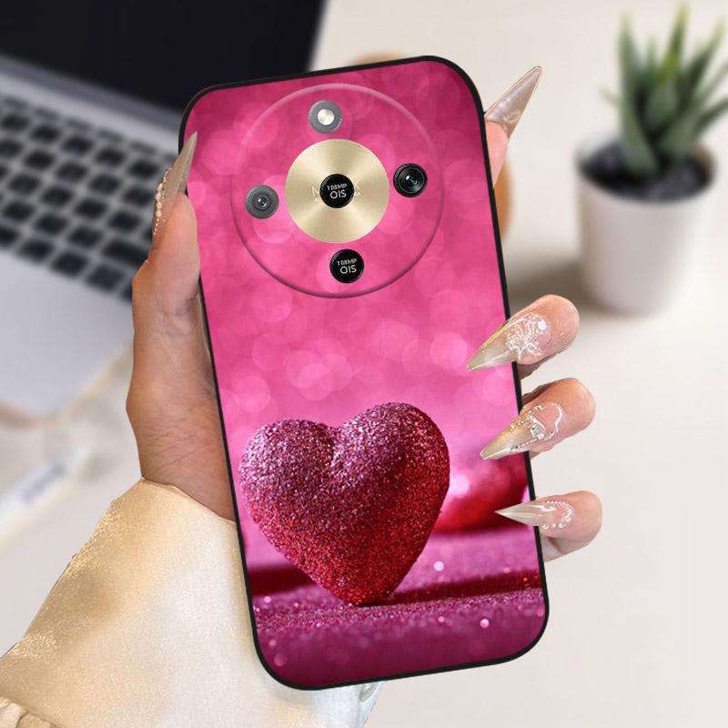 For Honor X9d Case X70 MTN-AN00 Stylish Cute Cartoon Cover Soft TPU Silicone Phone Case For Honor Magic 8 Magic8 X70 Fundas Capa