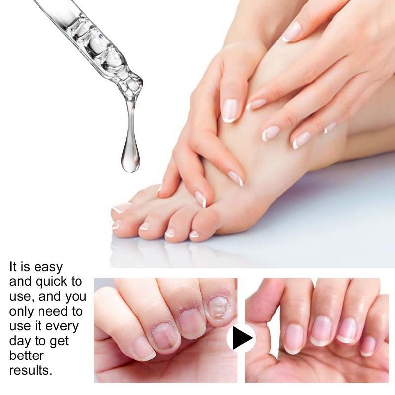 Nourishing Jaysuing Nail Repair Essence For Healthy Strong Nails 30ml