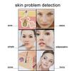 50X/200X Hair Follicle Scalp Skin Analyzer Detection Magnifying Microscope LCD Digital Dermatoscope Scalp Hair Detector Tester