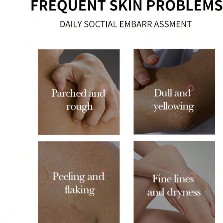 1PC AHA Fruit Acid Body Lotion Moisturizes And Removes Dry Skin, Nourishing The Body,Soothing And Sm