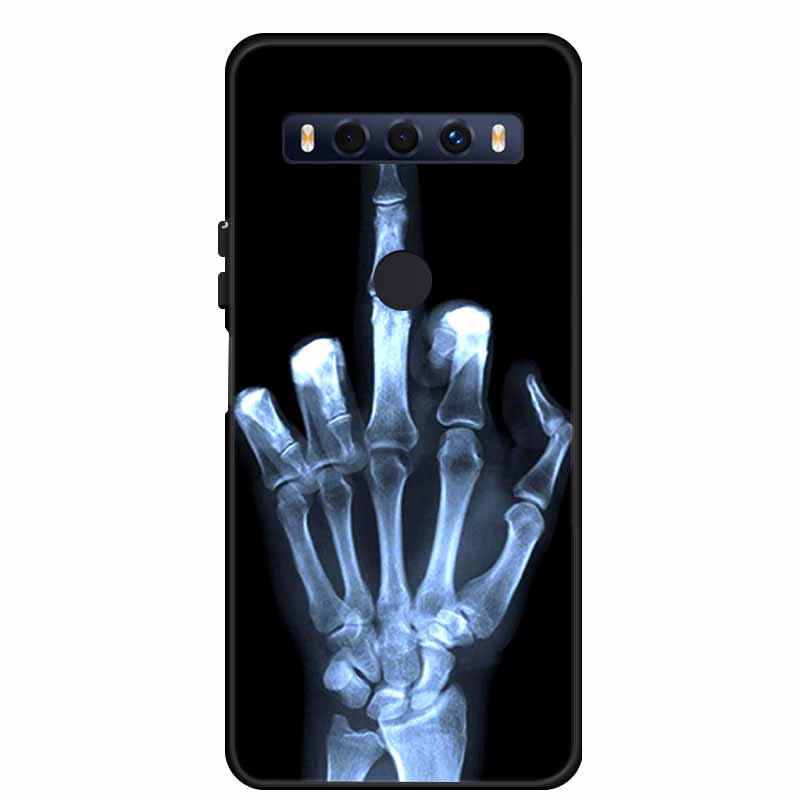 For TCL 10 SE Case Popular Picture Black Silicone Soft Back Cover Case For TCL 10 SE Phone Case Cover 10SE 6.52" Coque Funda Bag