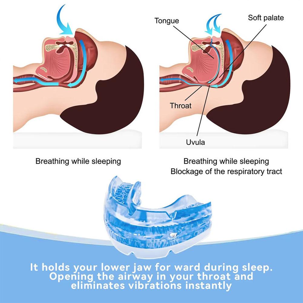 Anti-Snoring Mouthpiece Adjustable Mouth Guard for Women Men Snore Reducing Comfortable Oral Appliance Snoring Relief Device