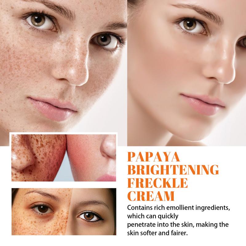 Papaya Whitening Freckle Cream Fades Facial Freckles and Dark Spots, Brightens and Moisturizes Skin Morning and Night Cream
