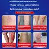 Varicose veins special plaster cold compress gel earthworm legs old rotten legs vascular blockage dredging imported medicine
